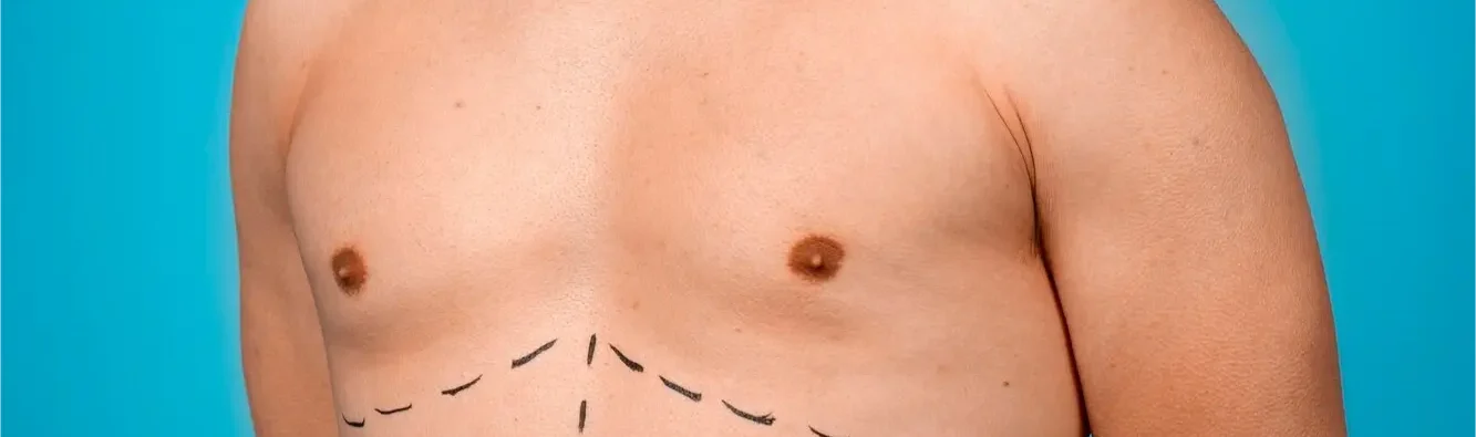Breast Cosmetic Procedures